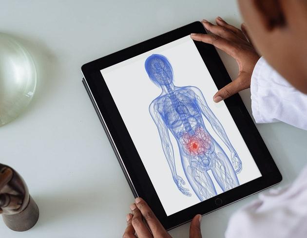 La composición de la microbiota intestinal es clave para la salud. 